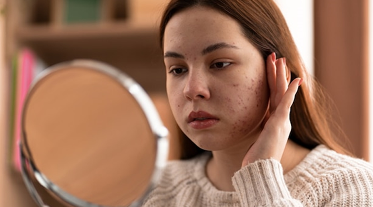 The Vital Role of Estheticians in Managing Skin Conditions